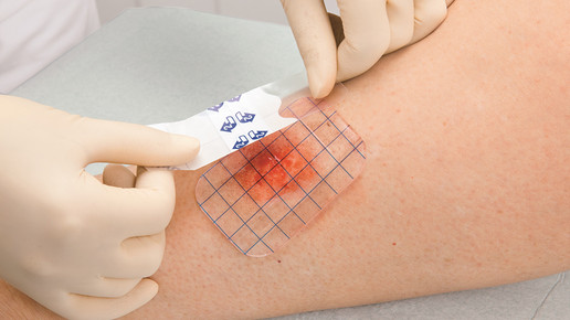 hartmann hydrosorb hartmann