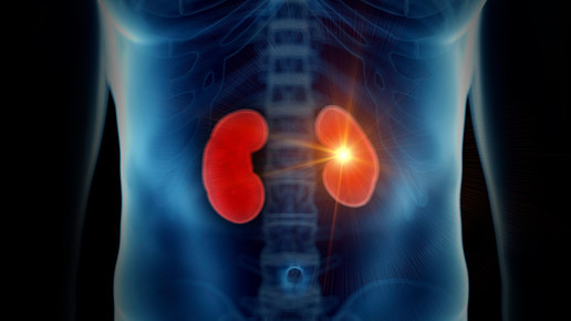 Selbstmedikation bei Niereninsuffizienz