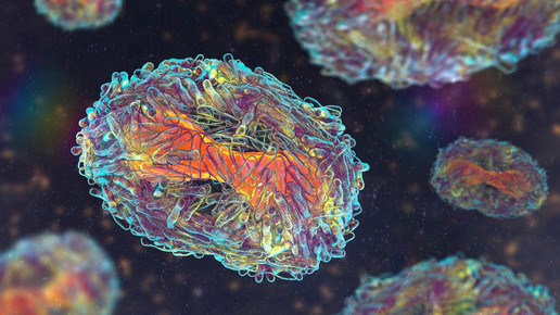 Mpox statt Monkeypox