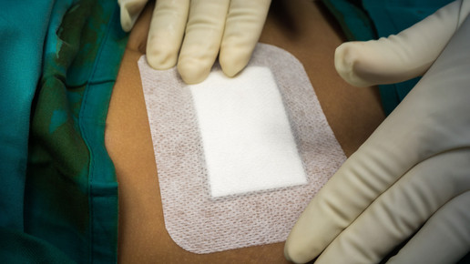 Neuer Silikonverband: Blutstillung ohne Verkleben