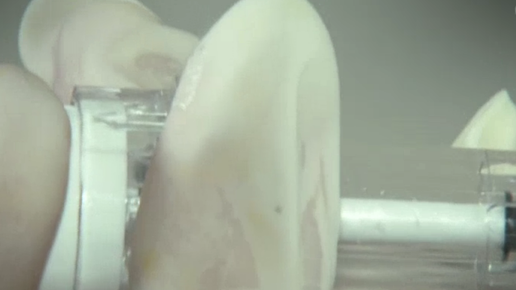 Europajournal Novartis Studien Polen Spritze02 Daserste