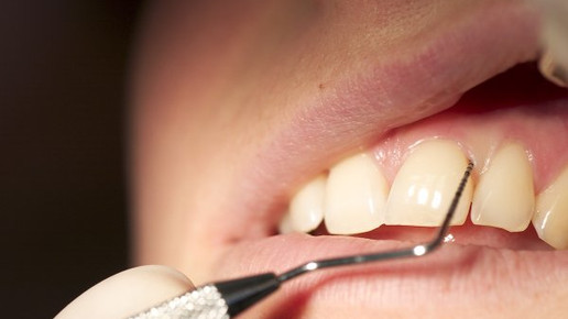 cysteamin at flasche aa