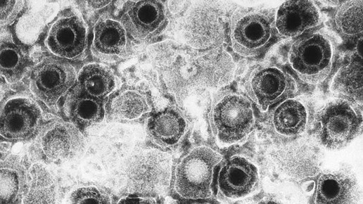 herpes virus CDC Dr Fred Murphy