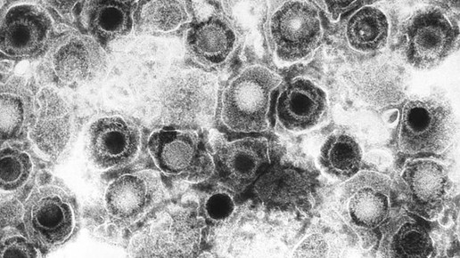 herpes virus CDC Dr Fred Murphy