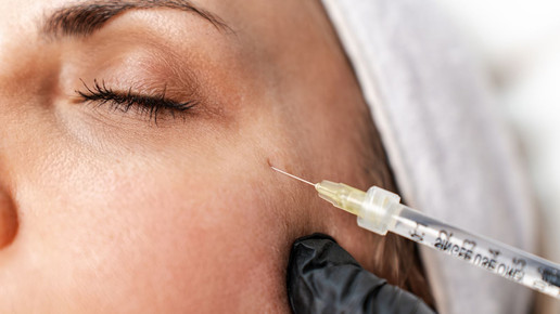 Hämatome und Schmerzen nach Hyaluron-Spritzen