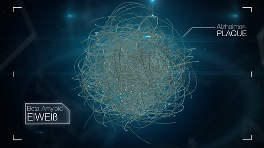 Studie abgebrochen: Hoffnungsträger erreicht Ziele nicht