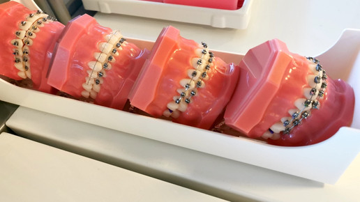 Gericht verbietet Gratis-Diagnosen