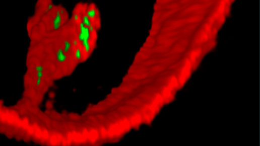 Pseudomonas aeruginosa Eierhoff Universita  t Freiburg