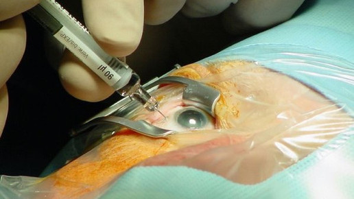 makula Universita  tsaugenklinik Ulm Prof Lang