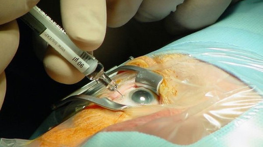 PKV darf Apotheke zuweisen