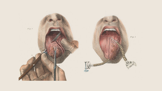 victorian zunge 02 wellcomecollection