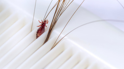 Läusemittel: Verschreibungen nehmen zu