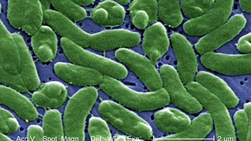 Vibrio vulnificus CDC Janice Haney Carr
