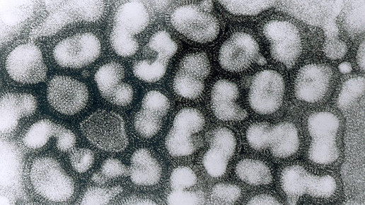 vogelgrippe Influenza A cdc Dr Erskine Palmer