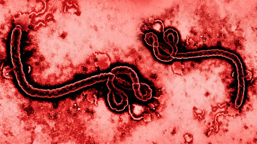 Ebola-Variante: Moderna will Impfstoff entwickeln