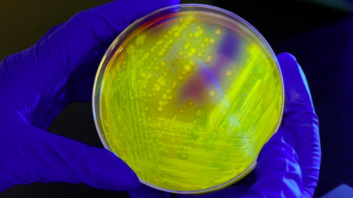 bakterien CDC melissa dankel