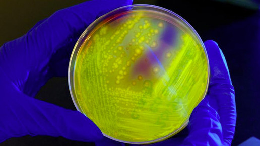 700.000 Tote jährlich durch Antibiotika-Resistenz