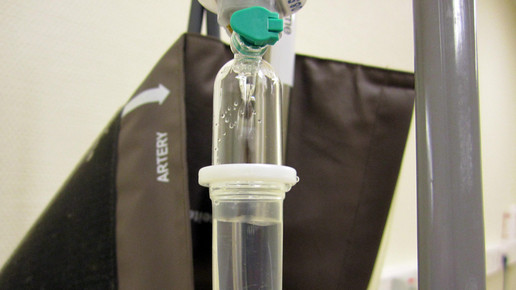 Behandlungsfehler: Jede Minute sterben fünf Menschen