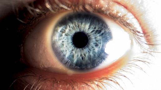 Mit Kopfschmerzen zum Augenarzt