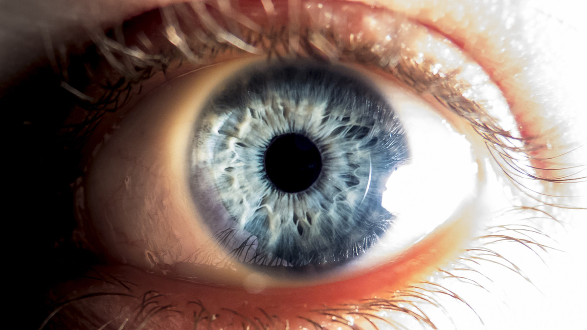 Kimmtrak: Fusionsprotein bei Tumor im Auge