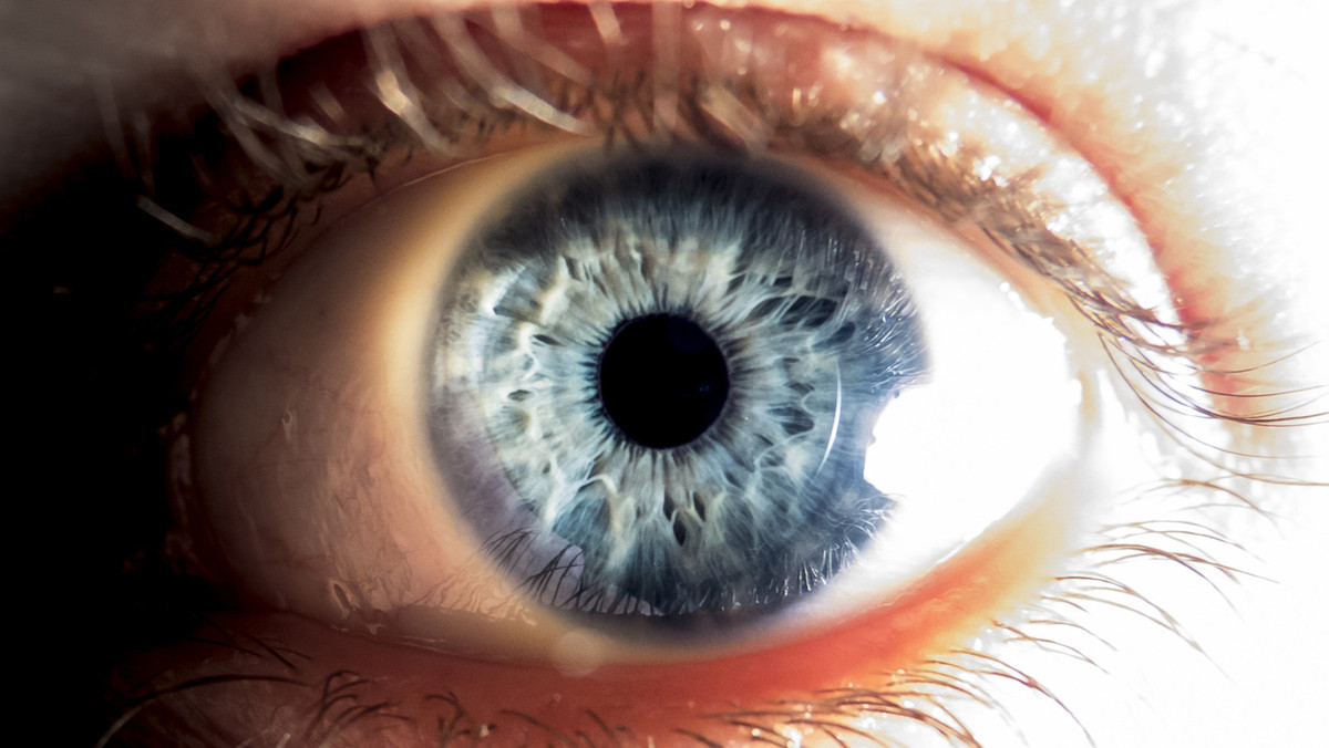 Sanpaku – das dreifach weiße Auge | APOTHEKE ADHOC