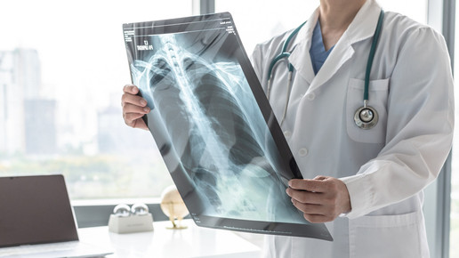 Covid-19: Spätfolgen möglich