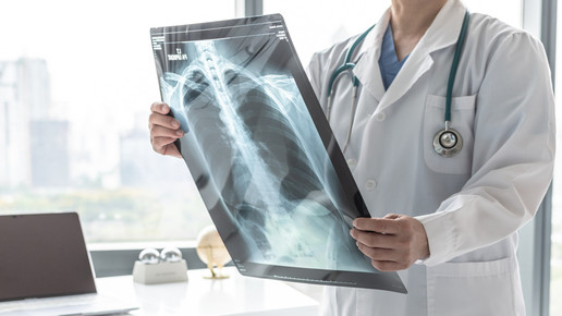 Symbolbild: Arzt mit Röntgenbild