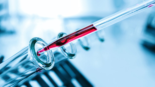 Helmholtz-Institut wertet 60.000 Blutproben aus