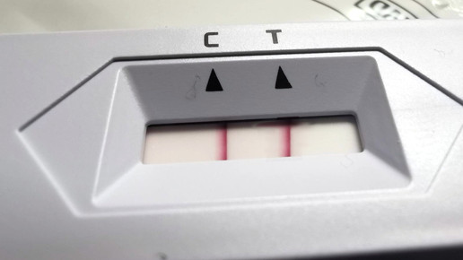 FDA: Antigentests erkennen Omikron nicht so gut