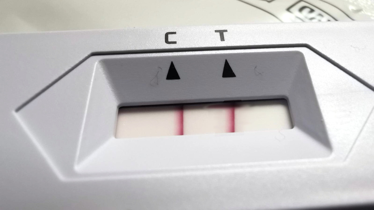 Labore überlastet – PCR-Tests in Apotheken könnten helfen