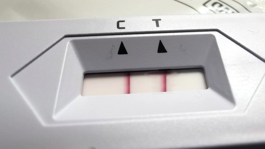 Omikron-Infizierte weisen ungewöhnlich starke Viruslast auf