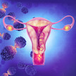 Endometriose: Spielen Fusobakterien eine Rolle?