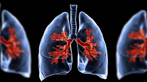 COPD: Grund für Lungenschäden entdeckt