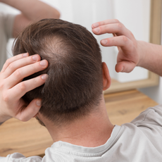 Haarausfall in der Beratung - Individuelle Rezepturen gewinnen an Bedeutung