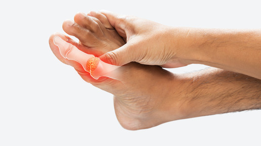 Fuß mit rotem Gelenk