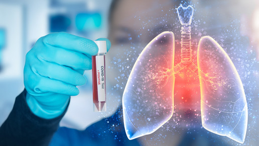 Ruconest: Conestat alfa bei Covid-19