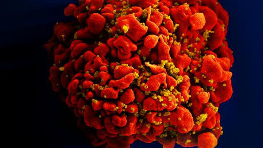 hiv gelb 18143 NIAID CDC