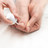 Nagelpilz: Diese Mittel helfen Nagelpilz: Diese Mittel helfen