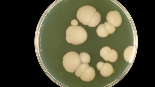 Ratiopharm bringt Anidulafungin