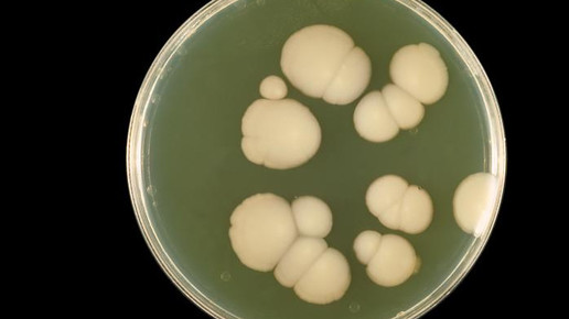 MRSA: Bedrohung durch multiresistente Pilze