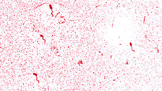 Vibrio chlolerae CDC