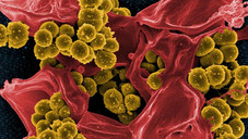 staphylococcus aureus NIAID Schnell-Check: Antibiotika