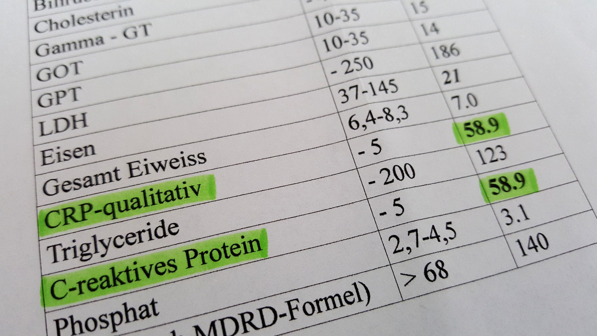 Wie Hoch Ist Der Crp-Wert Bei Tumoren? Wichtige Fakten & Tipps