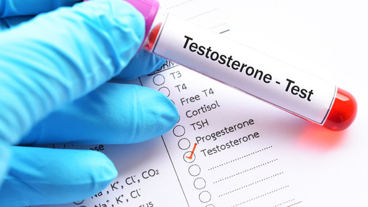 Testosteron: Schwere Nebenwirkungen bei falscher Injektion