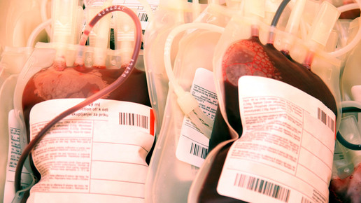 Homosexuelle Männer: Blutspenderegeln gelockert