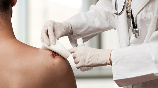 Wundheilung 2.0: Hydrogel heilt sich selbst