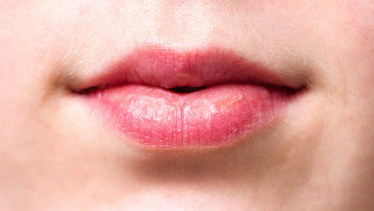 Fünf Tipps gegen trockene Lippen