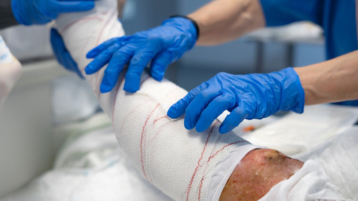 Brandopfer: Kabeljau-Haut boostert Heilung