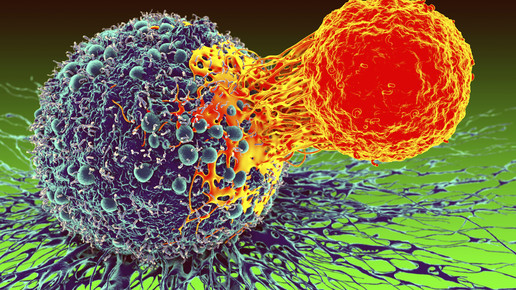 Krebszelle wird von T-Zelle attackiert