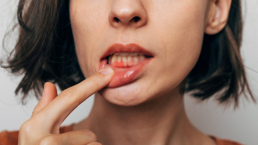 Wie kann die Zahn- und Mundgesundheit verbessert werden?